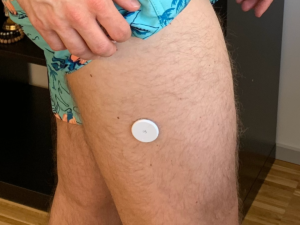 Best Freestyle Libre Sensor Locations: Thigh & Leg – Type One Talks